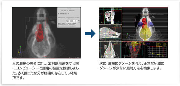 治療計画(シュミレーション)